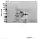 Fig. 02 - BACTERIAL STRAIN COMPOSITIONS AND METHODS OF USING SAME
