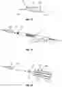 Fig. 08 - DEVICE AND METHOD FOR INTRAOSSEOUS DENTAL ANESTHETIZATION