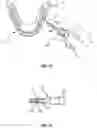 Fig. 09 - DEVICE AND METHOD FOR INTRAOSSEOUS DENTAL ANESTHETIZATION