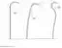 Fig. 02 - Double steerable sheath and method for deployment of a medical device