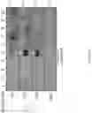 Fig. 37 - COMPOSITIONS COMPRISING 15-HEPE AND/OR 15-HETrE AND METHODS OF TREATING OR PREVENTING CARDIOMETABOLIC DISEASE, METABOLIC SYNDROME, AND/OR RELATED DISEASES