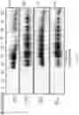 Fig. 40 - COMPOSITIONS COMPRISING 15-HEPE AND/OR 15-HETrE AND METHODS OF TREATING OR PREVENTING CARDIOMETABOLIC DISEASE, METABOLIC SYNDROME, AND/OR RELATED DISEASES
