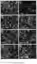 Fig. 03 - PROLYLHYDROXYLASE/ATF4 INHIBITORS AND METHODS OF USE FOR TREATING NEURAL CELL INJURY OR DEATH AND CONDITIONS RESULTING THEREFROM