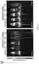 Fig. 10 - PROLYLHYDROXYLASE/ATF4 INHIBITORS AND METHODS OF USE FOR TREATING NEURAL CELL INJURY OR DEATH AND CONDITIONS RESULTING THEREFROM