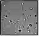 Fig. 01 - Fructophilic lactic acid producing bacteria