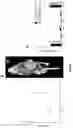 Fig. 08 - PROTOCOL FOR MINIMIZING TOXICITY OF COMBINATION DOSAGES AND IMAGING AGENT FOR VERIFICATION