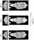 Fig. 09 - PROTOCOL FOR MINIMIZING TOXICITY OF COMBINATION DOSAGES AND IMAGING AGENT FOR VERIFICATION
