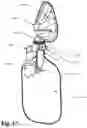 Fig. 09 - MODULAR PULMONARY TREATMENT SYSTEM