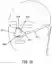 Fig. 22 - Methods, systems and devices for non-invasive open ventilation with gas delivery nozzles within nasal pillows