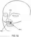 Fig. 35 - Methods, systems and devices for non-invasive open ventilation with gas delivery nozzles within nasal pillows