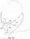 Fig. 41 - Methods, systems and devices for non-invasive open ventilation with gas delivery nozzles within nasal pillows