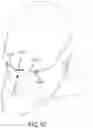 Fig. 49 - Methods, systems and devices for non-invasive open ventilation with gas delivery nozzles within nasal pillows