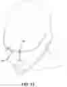 Fig. 53 - Methods, systems and devices for non-invasive open ventilation with gas delivery nozzles within nasal pillows