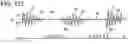 Fig. 83 - Methods, systems and devices for non-invasive open ventilation with gas delivery nozzles within nasal pillows