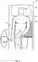 Fig. 02 - Extended introducer for left radial access