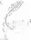 Fig. 03 - Extended introducer for left radial access
