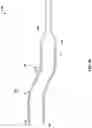 Fig. 05 - Extended introducer for left radial access