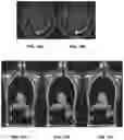 Fig. 16 - System and method for diagnostic and treatment