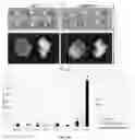 Fig. 04 - Molecular Size of Elastin-Like Polypeptide Delivery System for Therapeutics Modulates Deposition in the Placenta