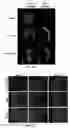 Fig. 05 - Molecular Size of Elastin-Like Polypeptide Delivery System for Therapeutics Modulates Deposition in the Placenta