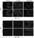 Fig. 17 - Molecular Size of Elastin-Like Polypeptide Delivery System for Therapeutics Modulates Deposition in the Placenta