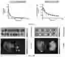 Fig. 20 - Molecular Size of Elastin-Like Polypeptide Delivery System for Therapeutics Modulates Deposition in the Placenta