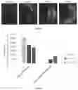 Fig. 28 - Molecular Size of Elastin-Like Polypeptide Delivery System for Therapeutics Modulates Deposition in the Placenta