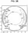 Fig. 04 - Soft contact lens with reduced volume variation