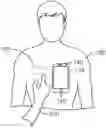 Fig. 01 - Implanted medical device authentication based on comparison of internal IMU signal to external IMU signal