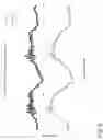 Fig. 08 - Implanted medical device authentication based on comparison of internal IMU signal to external IMU signal