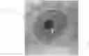 Fig. 01 - Image acquisition system for off-axis eye images