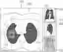 Fig. 01 - Method for aiding visualization of lesions in medical imagery and apparatus using the same