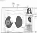 Fig. 02 - Method for aiding visualization of lesions in medical imagery and apparatus using the same