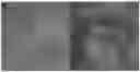 Fig. 01 - SYSTEM, METHOD AND COMPUTER-ACCESSIBLE MEDIUM FOR CLASSIFYING BREAST TISSUE USING A CONVOLUTIONAL NEURAL NETWORK