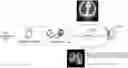 Fig. 01 - Object recognition method and device, and storage medium
