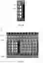 Fig. 08 - Artificial neural network-based method for detecting surface pattern of object