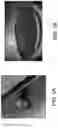 Fig. 04 - Trailer assist system with estimation of 3D location of hitch