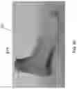 Fig. 12 - Method for calculating the comfort level of footwear