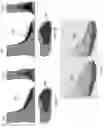 Fig. 13 - Method for calculating the comfort level of footwear