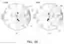 Fig. 07 - Filter including acoustic wave resonator