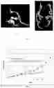 Fig. 03 - METHOD FOR CULTIVATING PARALARVAE OF THE COMMON OCTOPUS, OCTOPUS VULGARIS
