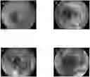 Fig. 01 - METHOD FOR ESTABLISHING ULCERATIVE COLITIS ANIMAL MODEL AND USE OF SAID MODEL