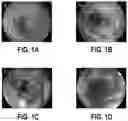 Fig. 02 - METHOD FOR ESTABLISHING ULCERATIVE COLITIS ANIMAL MODEL AND USE OF SAID MODEL