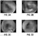 Fig. 03 - METHOD FOR ESTABLISHING ULCERATIVE COLITIS ANIMAL MODEL AND USE OF SAID MODEL