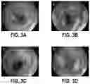 Fig. 04 - METHOD FOR ESTABLISHING ULCERATIVE COLITIS ANIMAL MODEL AND USE OF SAID MODEL