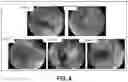 Fig. 05 - METHOD FOR ESTABLISHING ULCERATIVE COLITIS ANIMAL MODEL AND USE OF SAID MODEL