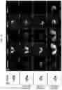 Fig. 05 - ENDONUCLEASE SEXING AND STERILIZATION IN INSECTS