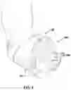 Fig. 03 - Diagnostic interactive applied shoe for horses