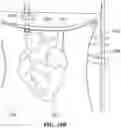 Fig. 28 - Apparatus for perfusion of an excised organ