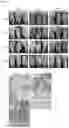 Fig. 08 - Method for inducing acquired resistance in a plant